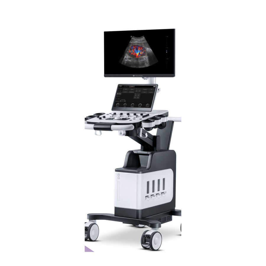 Ultrasound diagnostic system